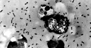 Madagascar : L’épidémie de peste nécessite des mesures d’urgence