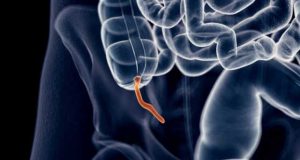 Santé : La maladie de Parkinson pourrait commencer dans l’appendice