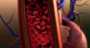 Science / Médecine : Une Colle Chirurgicale Arrête des Saignements en Quelques Secondes… vaisseau sanguin