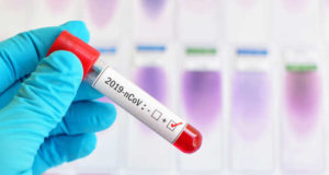 Togo, Coronavirus : Trop de laxisme…