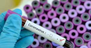 Gestion hasardeuse du Covid-19 au Togo : Relâchement et singerie suicidaires du gouvernement