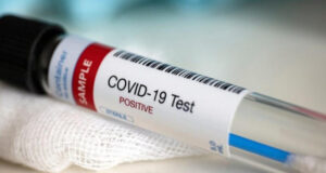 Togo, Covid-19 : Le Test de coronavirus payant, une décision dangereuse ! test covid-19